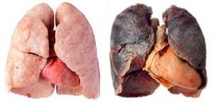 Plotselinge afdaling zin Inspiratie De gevolgen van roken voor je longen